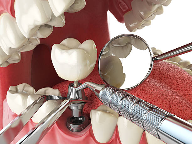 Best Emergency Orthodontic Repairs in Montevlo, AL